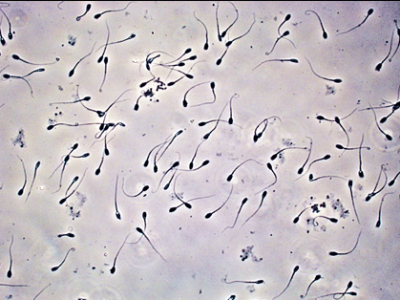 semen analysis under microscope